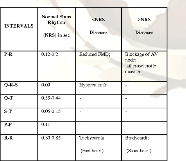 Figure 4 for Wavelet Based QRS Complex Detection of ECG Signal