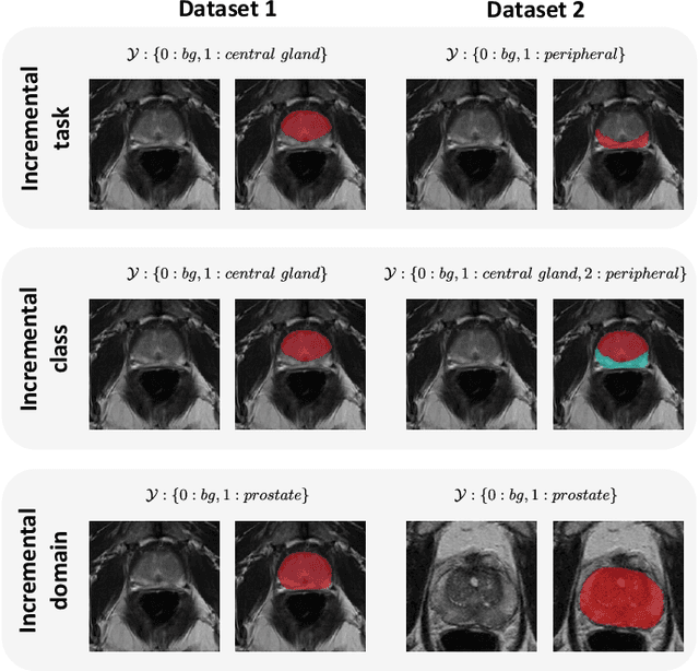 Figure 2 for What is Wrong with Continual Learning in Medical Image Segmentation?