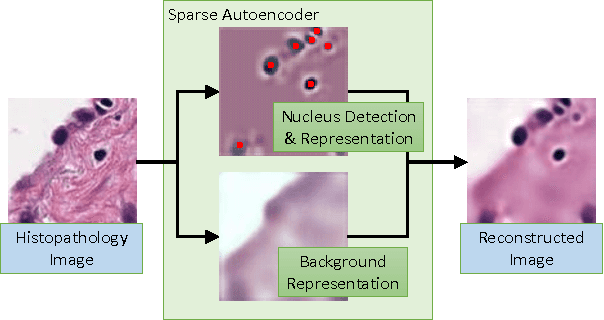 Figure 1 for Sparse Autoencoder for Unsupervised Nucleus Detection and Representation in Histopathology Images