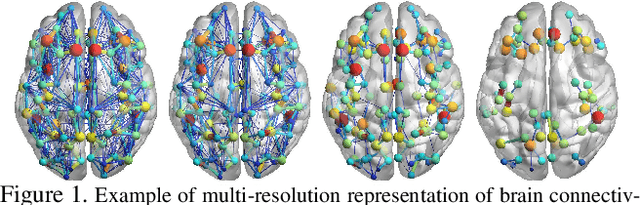 Figure 1 for Multi-resolution Graph Neural Network for Identifying Disease-specific Variations in Brain Connectivity