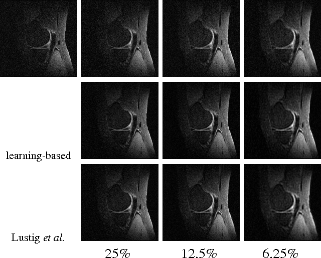 Figure 3 for Learning Data Triage: Linear Decoding Works for Compressive MRI