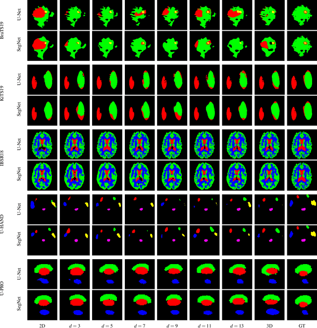 Figure 2 for Evaluation of Multi-Slice Inputs to Convolutional Neural Networks for Medical Image Segmentation
