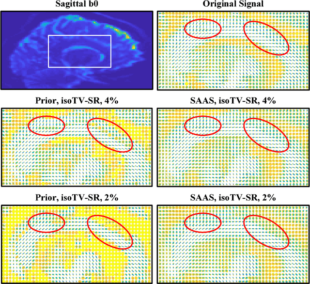 Figure 4 for (k,q)-Compressed Sensing for dMRI with Joint Spatial-Angular Sparsity Prior