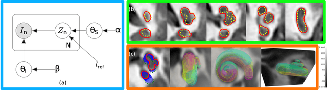 Figure 4 for Bayesian Logistic Shape Model Inference: application to cochlea image segmentation