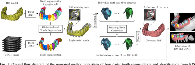Figure 1 for Fully automatic integration of dental CBCT images and full-arch intraoral impressions with stitching error correction via individual tooth segmentation and identification