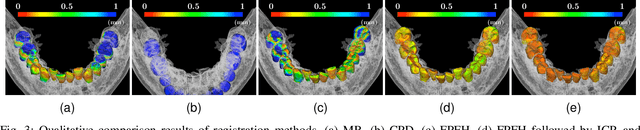 Figure 3 for Fully automatic integration of dental CBCT images and full-arch intraoral impressions with stitching error correction via individual tooth segmentation and identification