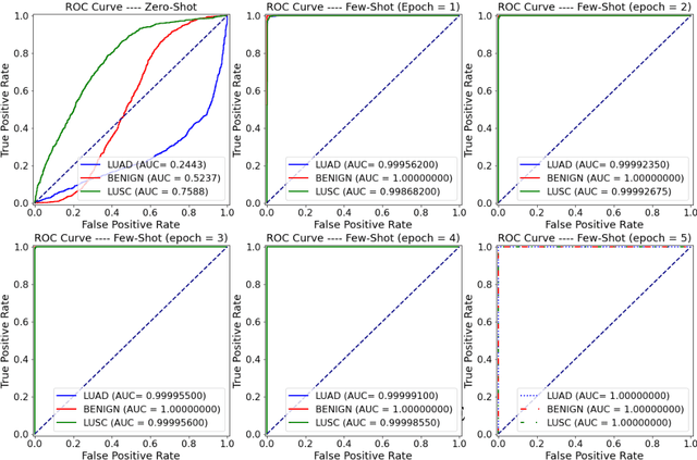 Figure 3 for Zero-Shot and Few-Shot Learning for Lung Cancer Multi-Label Classification using Vision Transformer