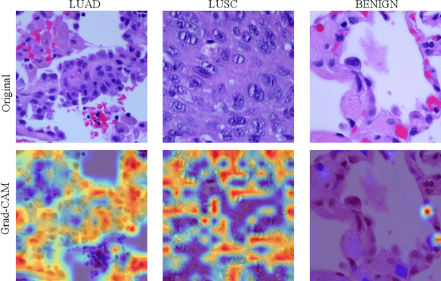 Figure 4 for Zero-Shot and Few-Shot Learning for Lung Cancer Multi-Label Classification using Vision Transformer