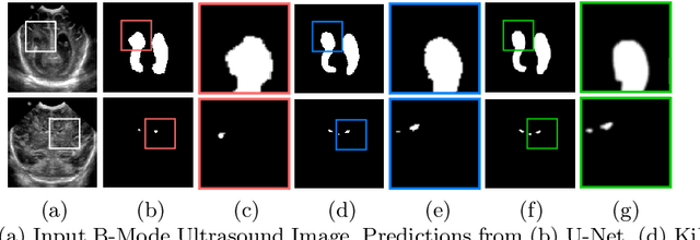 Figure 1 for KiU-Net: Towards Accurate Segmentation of Biomedical Images using Over-complete Representations
