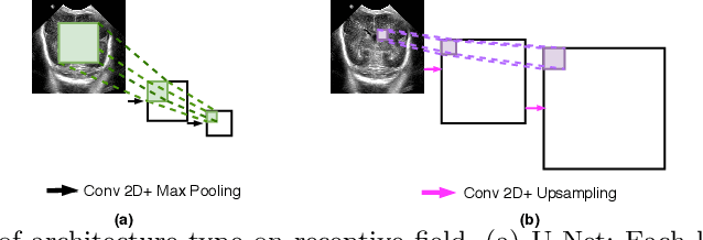 Figure 3 for KiU-Net: Towards Accurate Segmentation of Biomedical Images using Over-complete Representations