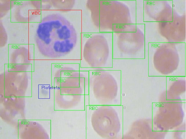 Figure 3 for Multi-Class Classification of Blood Cells -- End to End Computer Vision based diagnosis case study