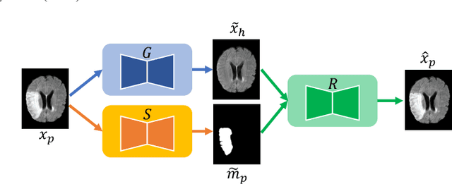 Figure 3 for Pseudo-healthy synthesis with pathology disentanglement and adversarial learning