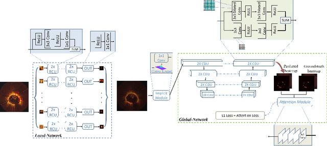 Figure 3 for Deep Local Global Refinement Network for Stent Analysis in IVOCT Images