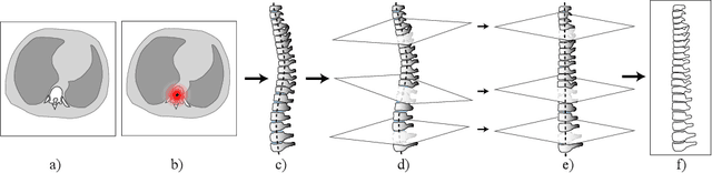 Figure 3 for Keypoints Localization for Joint Vertebra Detection and Fracture Severity Quantification