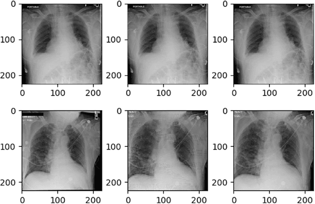 Figure 1 for Attack-agnostic Adversarial Detection on Medical Data Using Explainable Machine Learning