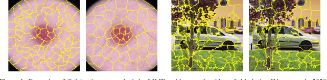 Figure 1 for LIMEcraft: Handcrafted superpixel selection and inspection for Visual eXplanations