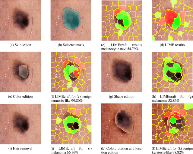 Figure 3 for LIMEcraft: Handcrafted superpixel selection and inspection for Visual eXplanations
