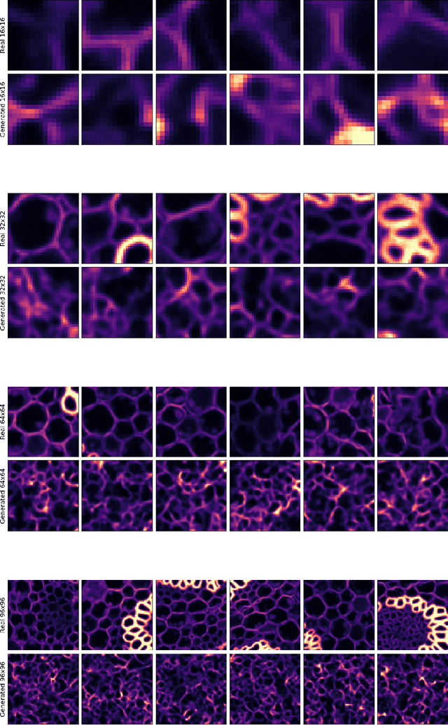 Figure 4 for DivNoising: Diversity Denoising with Fully Convolutional Variational Autoencoders