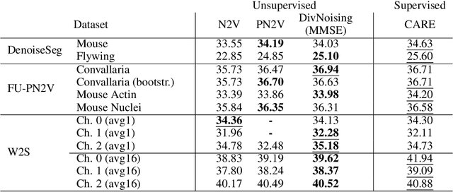 Figure 1 for DivNoising: Diversity Denoising with Fully Convolutional Variational Autoencoders