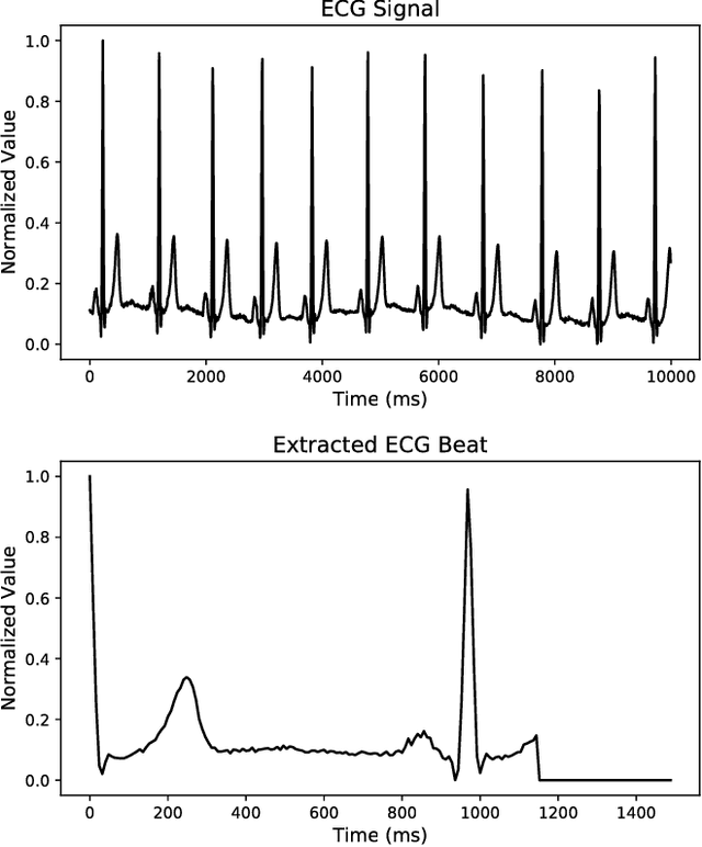 Figure 1 for ECG Heartbeat Classification: A Deep Transferable Representation