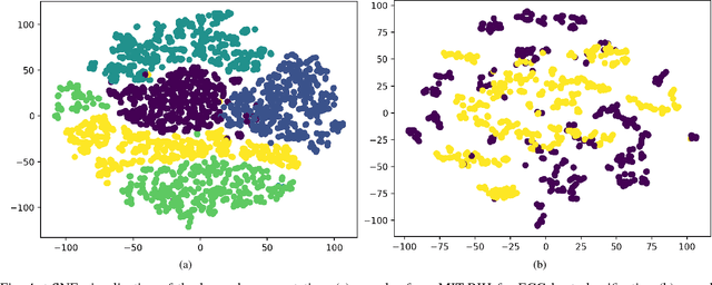 Figure 4 for ECG Heartbeat Classification: A Deep Transferable Representation