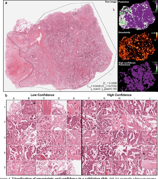 Figure 4 for Uncertainty-Informed Deep Learning Models Enable High-Confidence Predictions for Digital Histopathology