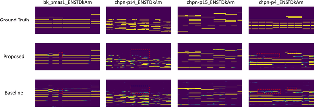 Figure 2 for The Effect of Spectrogram Reconstruction on Automatic Music Transcription: An Alternative Approach to Improve Transcription Accuracy