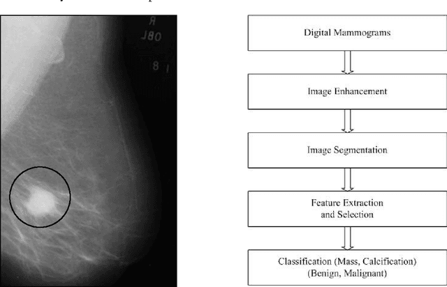 Figure 1 for An Efficient Automatic Mass Classification Method In Digitized Mammograms Using Artificial Neural Network