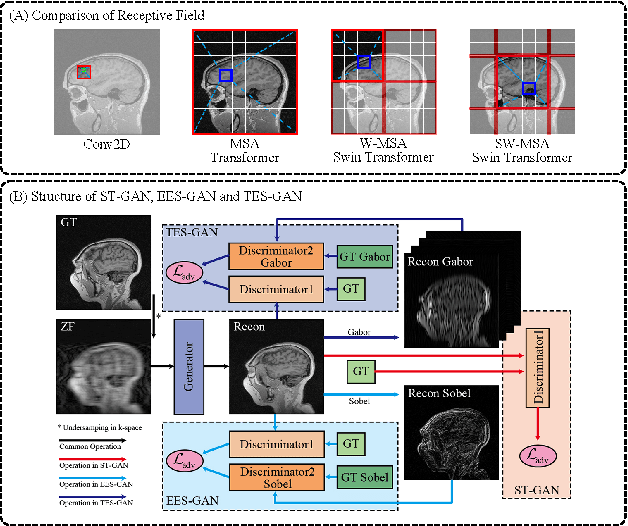 Figure 1 for Fast MRI Reconstruction: How Powerful Transformers Are?