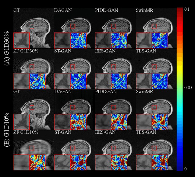 Figure 3 for Fast MRI Reconstruction: How Powerful Transformers Are?