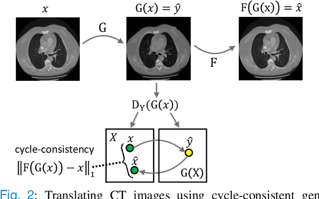 Figure 2 for CyTran: Cycle-Consistent Transformers for Non-Contrast to Contrast CT Translation