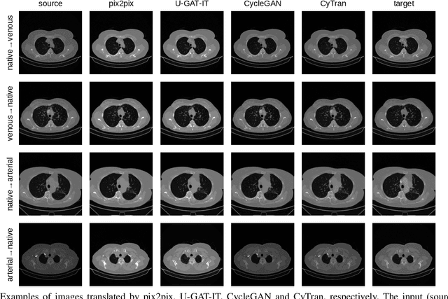 Figure 4 for CyTran: Cycle-Consistent Transformers for Non-Contrast to Contrast CT Translation