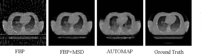 Figure 2 for Deep Learning Based Computed Tomography Whys and Wherefores