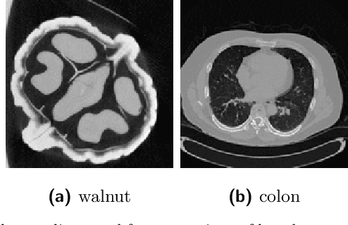 Figure 2 for Low radiation tomographic reconstruction with and without template information
