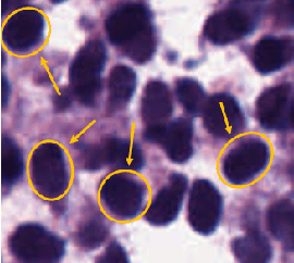 Figure 1 for Unsupervised Data-Driven Nuclei Segmentation For Histology Images