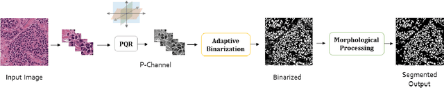 Figure 3 for Unsupervised Data-Driven Nuclei Segmentation For Histology Images