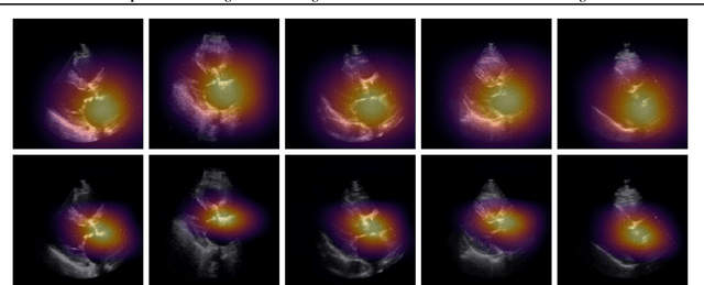 Figure 4 for Self-Supervised Learning of Echocardiogram Videos Enables Data-Efficient Clinical Diagnosis