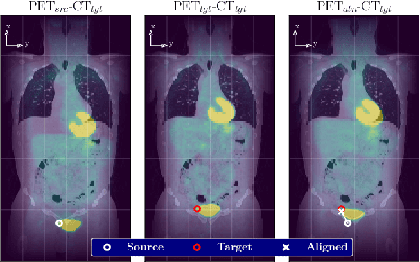 Figure 1 for Reducing the Human Effort in Developing PET-CT Registration