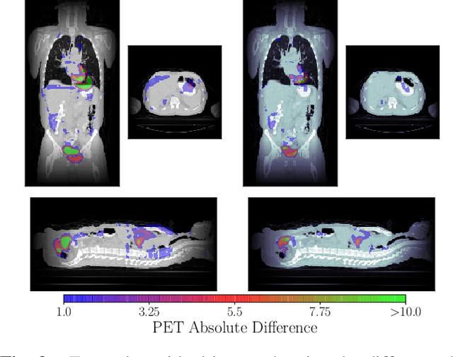 Figure 4 for Reducing the Human Effort in Developing PET-CT Registration