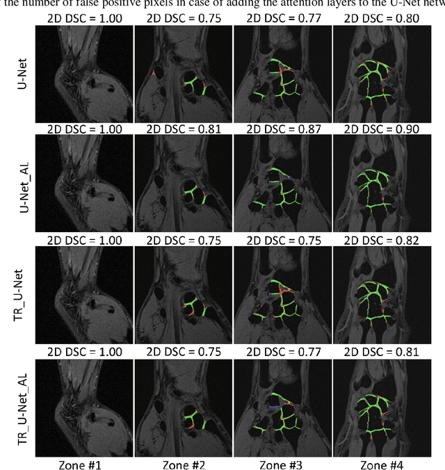 Figure 3 for CNN-based fully automatic wrist cartilage volume quantification in MR Image
