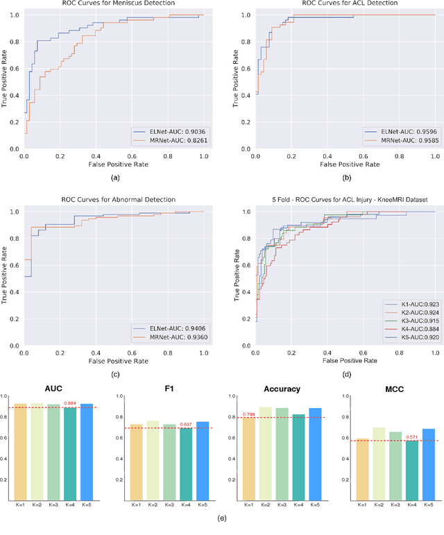 Figure 4 for Knee Injury Detection using MRI with Efficiently-Layered Network (ELNet)