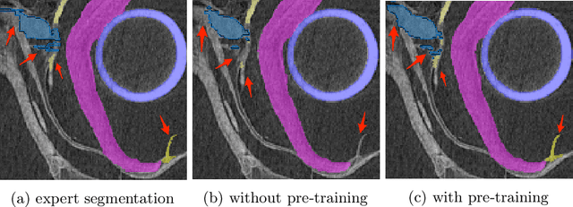 Figure 1 for Using the Order of Tomographic Slices as a Prior for Neural Networks Pre-Training