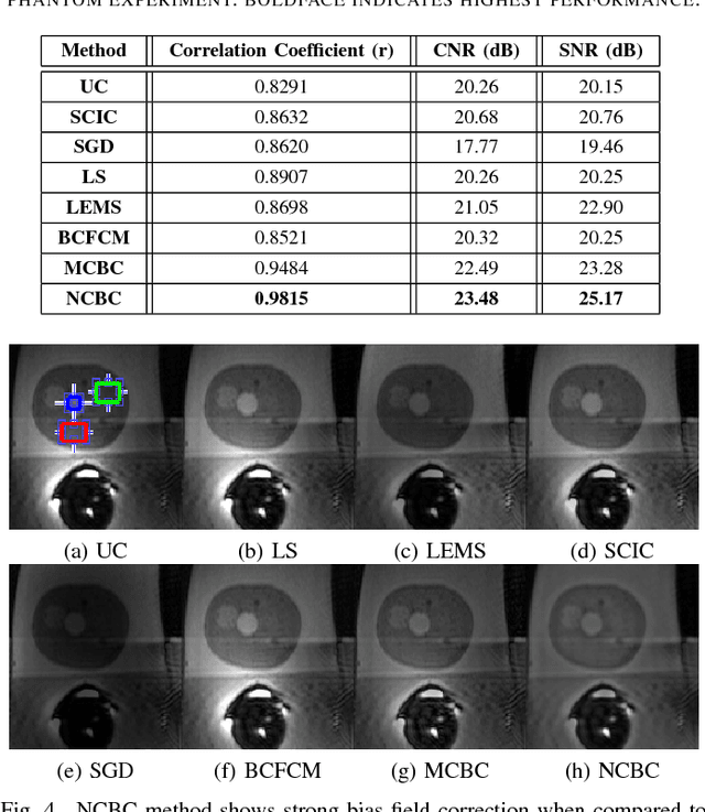 Figure 4 for Noise-Compensated, Bias-Corrected Diffusion Weighted Endorectal Magnetic Resonance Imaging via a Stochastically Fully-Connected Joint Conditional Random Field Model