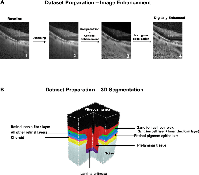 Figure 2 for Towards Label-Free 3D Segmentation of Optical Coherence Tomography Images of the Optic Nerve Head Using Deep Learning