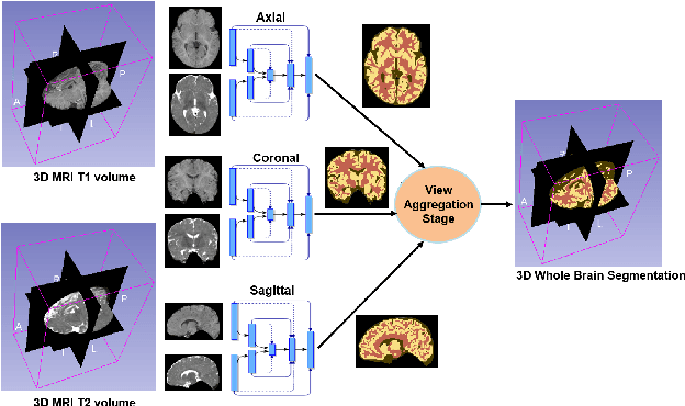 Figure 1 for InfiNet: Fully Convolutional Networks for Infant Brain MRI Segmentation