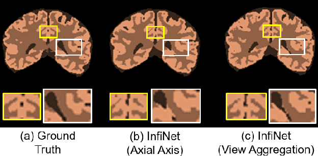 Figure 4 for InfiNet: Fully Convolutional Networks for Infant Brain MRI Segmentation