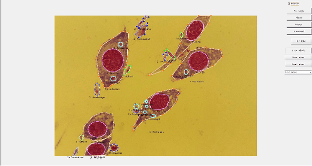 Figure 1 for Leishmaniasis Parasite Segmentation and Classification using Deep Learning