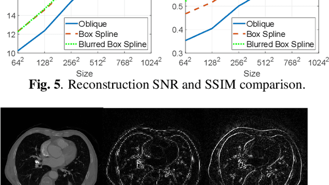 Figure 4 for Gram filtering and sinogram interpolation for pixel-basis in parallel-beam X-ray CT reconstruction