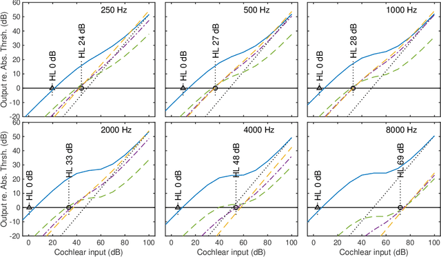 Figure 4 for WHIS: Hearing impairment simulator based on the gammachirp auditory filterbank