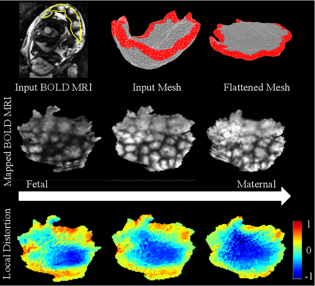 Figure 2 for Placental Flattening via Volumetric Parameterization